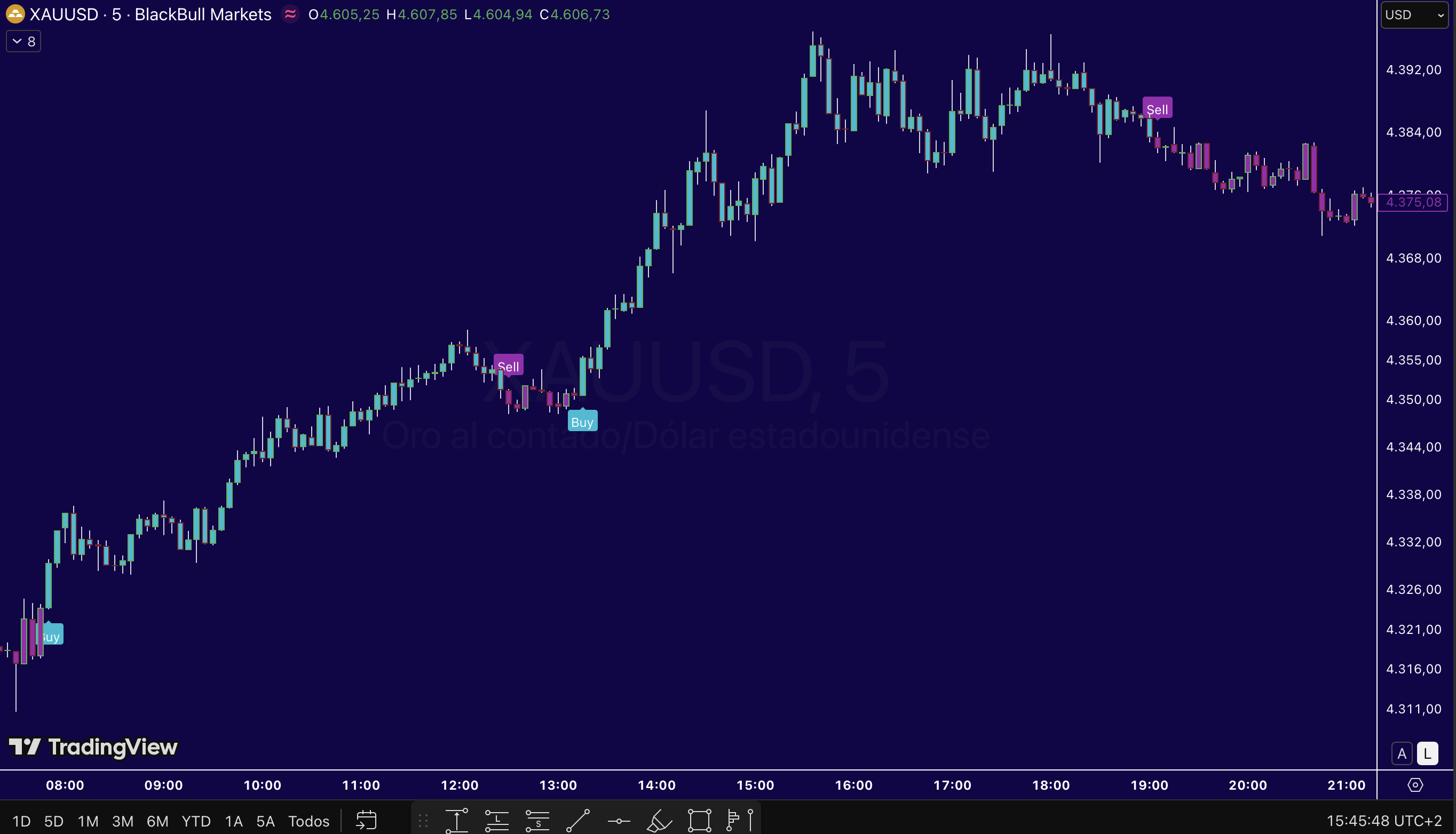 Ejemplo de señales del indicador XAU Radar